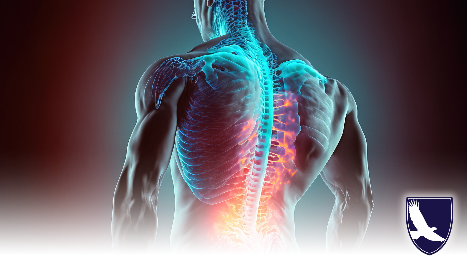 CAN I GET SOCIAL SECURITY DISABILITY FOR BACK PAIN